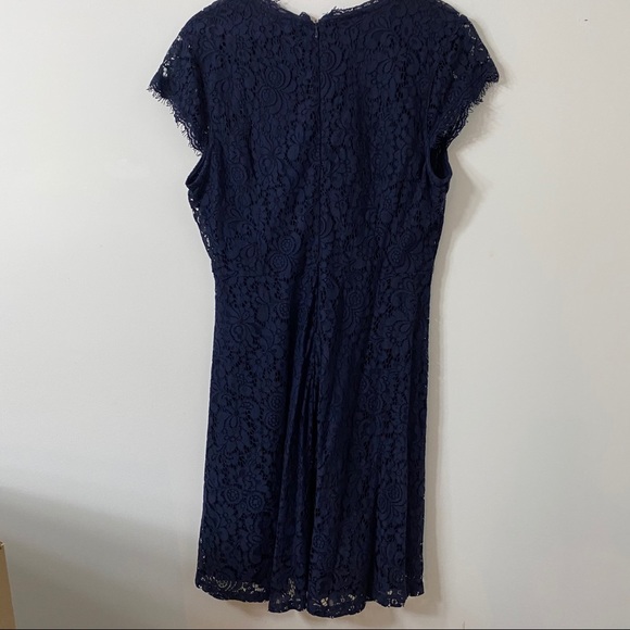 H&M Lace Dress - Picture 5 of 11